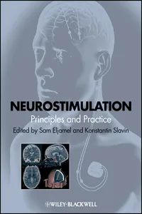 Neurostimulation_cover