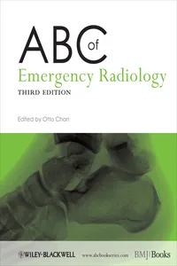 ABC of Emergency Radiology_cover