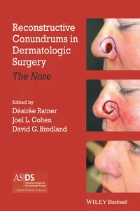 Reconstructive Conundrums in Dermatologic Surgery_cover
