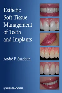 Esthetic Soft Tissue Management of Teeth and Implants_cover