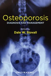 Osteoporosis_cover