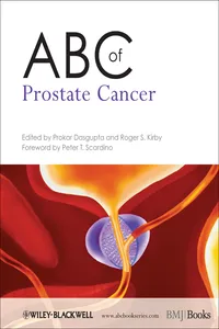 ABC of Prostate Cancer_cover