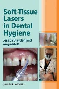 Soft-Tissue Lasers in Dental Hygiene_cover