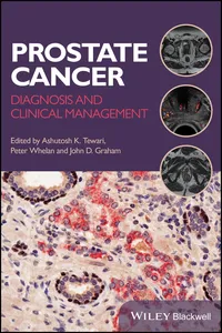 Prostate Cancer_cover