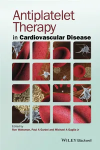 Antiplatelet Therapy in Cardiovascular Disease_cover