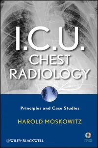 I.C.U. Chest Radiology_cover