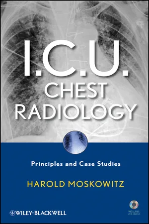 I.C.U. Chest Radiology