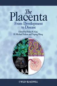 The Placenta_cover