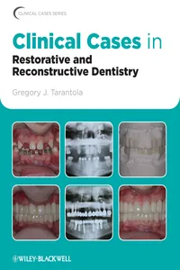 Clinical Cases in Restorative and Reconstructive Dentistry_cover