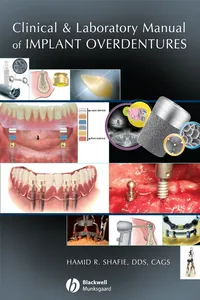 Clinical and Laboratory Manual of Implant Overdentures_cover