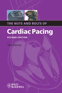The Nuts and Bolts of Cardiac Pacing_cover