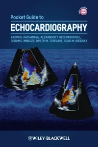 Pocket Guide to Echocardiography_cover