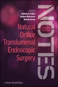 Natural Orifice Translumenal Endoscopic Surgery_cover