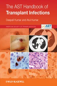 The AST Handbook of Transplant Infections_cover