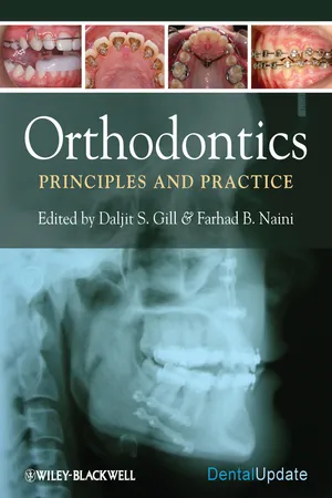 Orthodontics