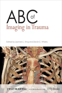 ABC of Imaging in Trauma_cover