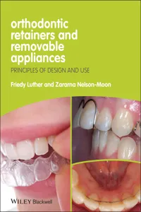 Orthodontic Retainers and Removable Appliances_cover