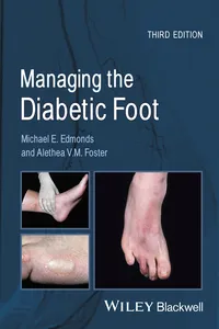 Managing the Diabetic Foot_cover