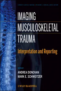 Imaging Musculoskeletal Trauma_cover