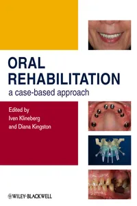 Oral Rehabilitation_cover