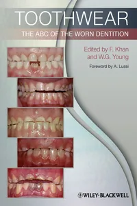 Toothwear_cover