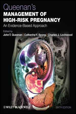 Queenan's Management of High-Risk Pregnancy