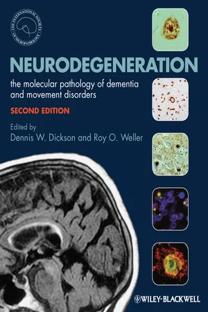 Neurodegeneration