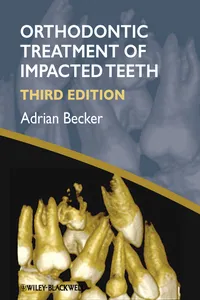 Orthodontic Treatment of Impacted Teeth_cover