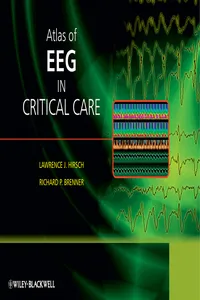 Atlas of EEG in Critical Care_cover