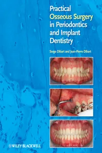 Practical Osseous Surgery in Periodontics and Implant Dentistry_cover