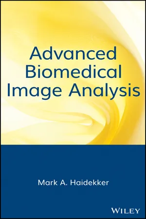 Book cover image for: Advanced Biomedical Image Analysis