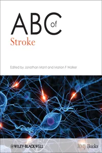 ABC of Stroke_cover