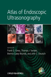 Atlas of Endoscopic Ultrasonography_cover