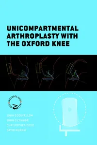 Unicompartmental Arthroplasty with the Oxford Knee_cover