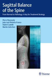 Sagittal Balance of the Spine_cover