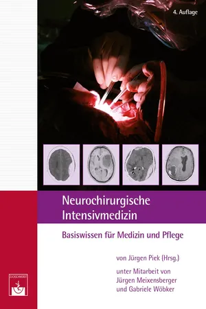 Neurochirurgische Intensivmedizin