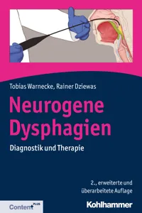 Neurogene Dysphagien_cover