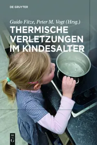 Thermische Verletzungen im Kindesalter_cover