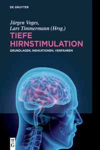 Tiefe Hirnstimulation_cover