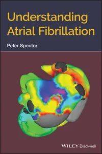 Understanding Atrial Fibrillation_cover