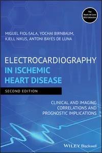 Electrocardiography in Ischemic Heart Disease_cover