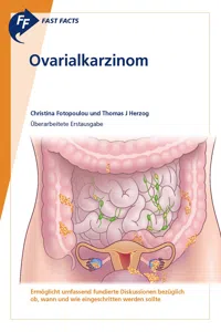 Fast Facts: Ovarialkarzinom_cover