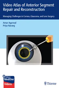 Video Atlas of Anterior Segment Repair and Reconstruction_cover