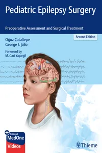 Pediatric Epilepsy Surgery_cover
