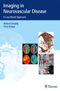 Imaging in Neurovascular Disease_cover