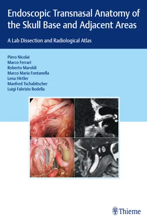 Endoscopic Transnasal Anatomy of the Skull Base and Adjacent Areas