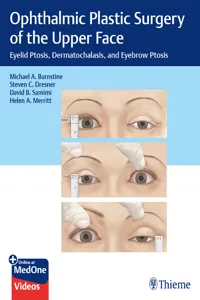 Ophthalmic Plastic Surgery of the Upper Face_cover