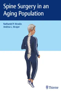 Spine Surgery in an Aging Population_cover
