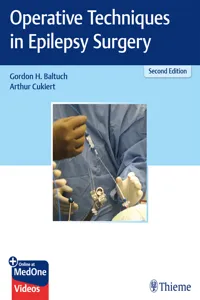 Operative Techniques in Epilepsy Surgery_cover