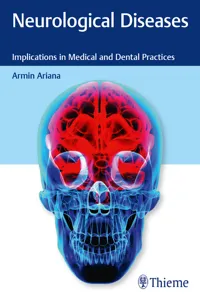 Neurological Diseases_cover